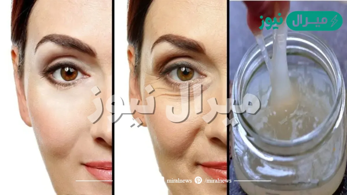 وصفة طبيعية للتخلص من تجاعيد حول العين والفم بكل سهولة وبأقل تكلفة