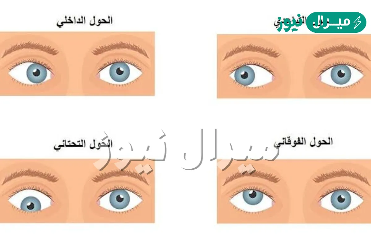الفرق بين الحول والحور