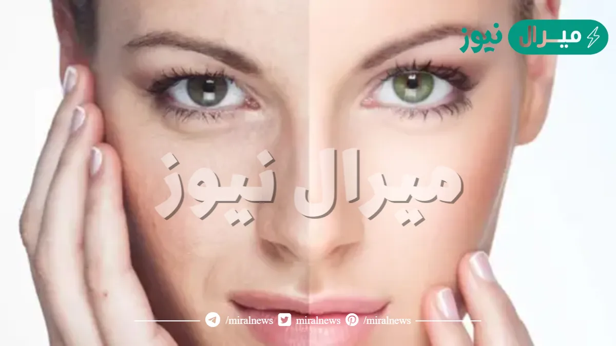 تجربتي في تبييض بشرتي خلال 30 يوم | خلطة سحرية لتبيض الوجه واليدين من تجربتي