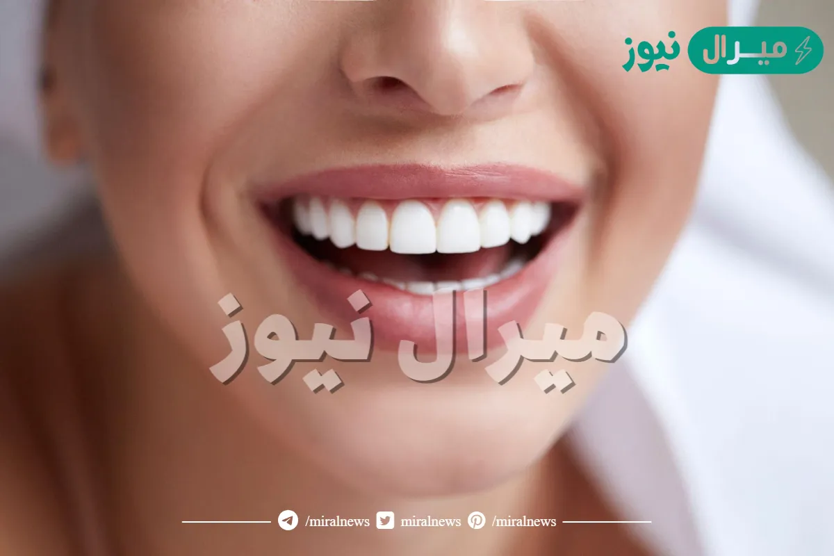 تجربتي مع اللومينير لتبيض الأسنان