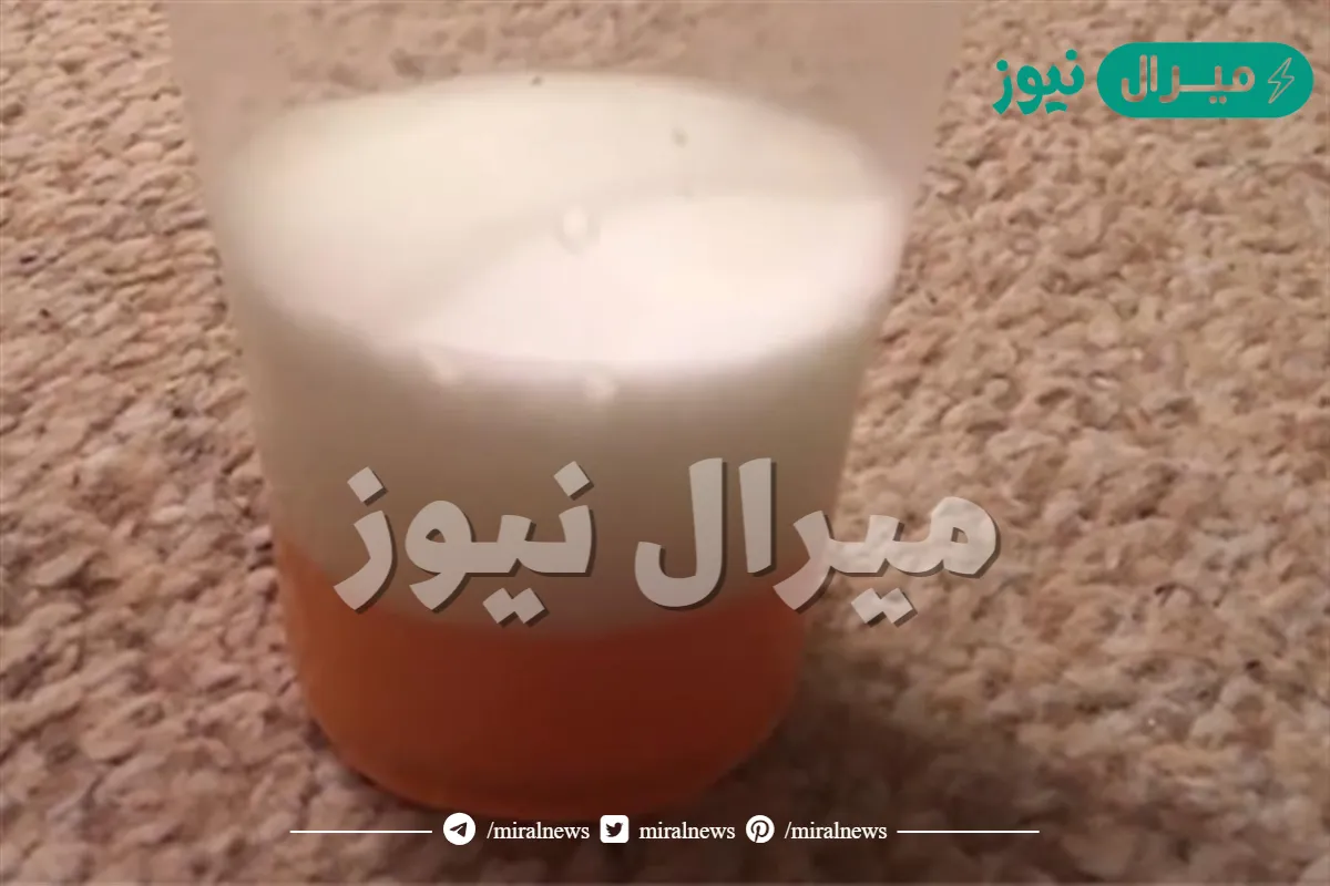 كيف اعرف اني حامل بالكلور ؟