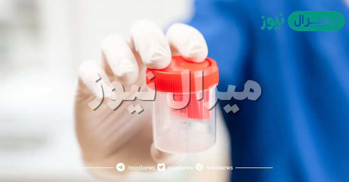 كيف اعرف نتيجة تحليل السائل المنوى