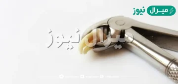 ماذا افعل بعد خلع الضرس