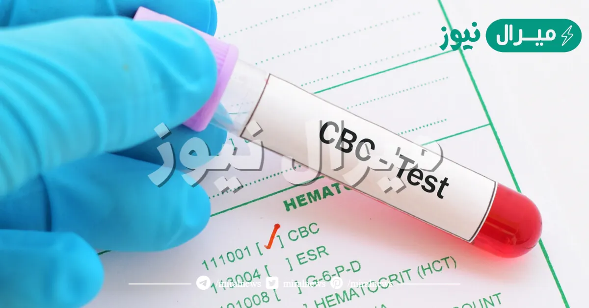 تحليل الدم الشامل ماذا يكشف
