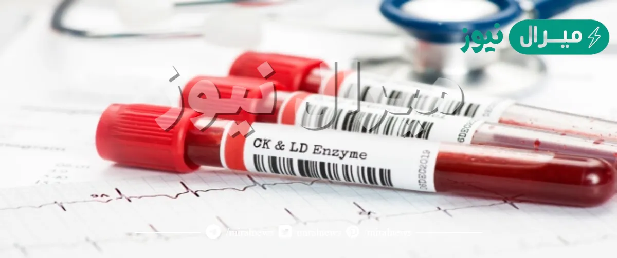 سبب ارتفاع الانزيمات في الدم