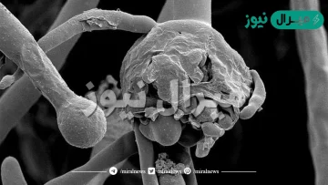 مرض الفطر الاسود في العين