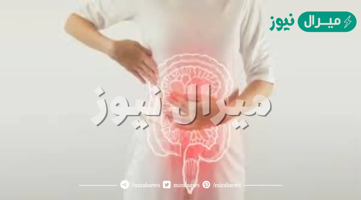 هل انفجار القولون يسبب الموت