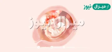 الاسبوع العاشر من الحمل