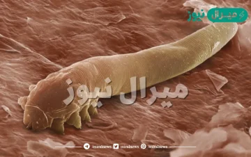 الديدان المفلطحة عديمة التجويف الجسمي صح او خطا