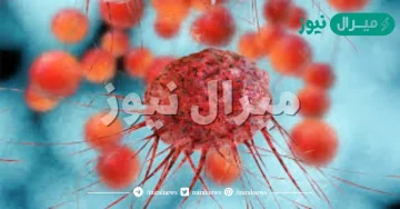 الفرق بين الورم الحميد والخبيث