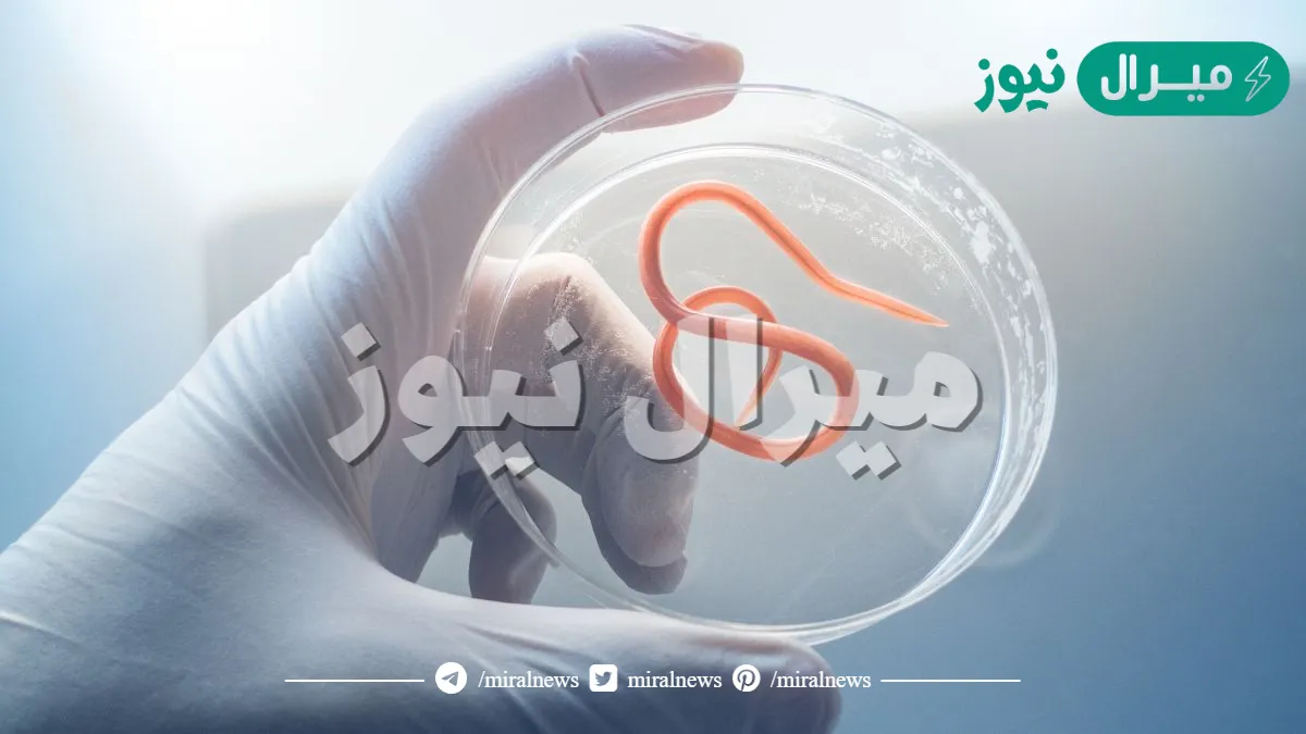 كيف تصيب دودة الإسكارس الإنسان