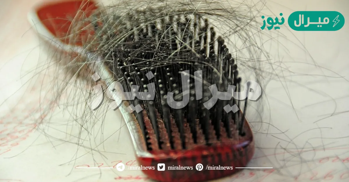 اسباب تساقط الشعر بكثرة