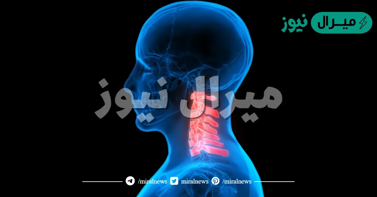 كم عدد فقرات الرقبة في جسم الإنسان