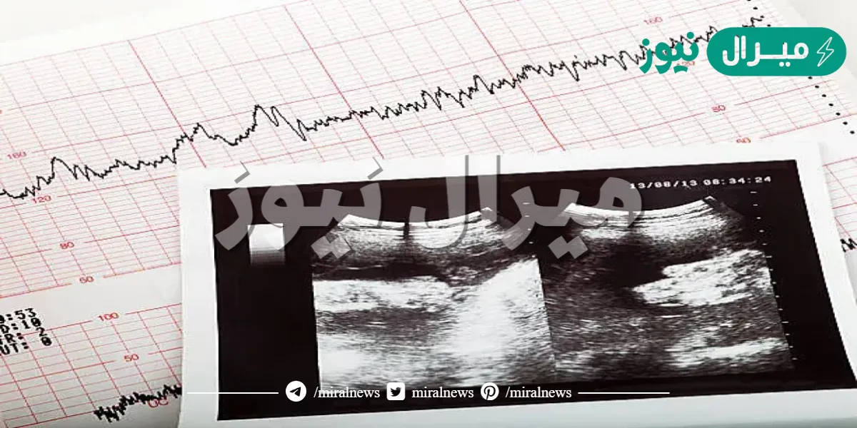 متى ينبض قلب الجنين في اي اسبوع