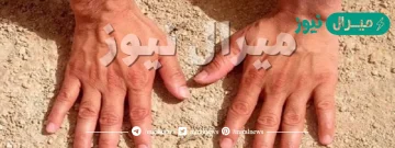 هل يجوز التيمم في البرد