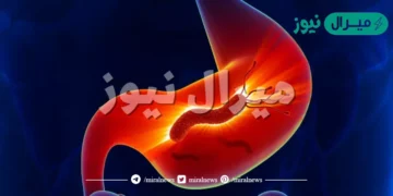 اعراض جرثومة المعدة