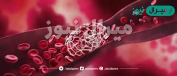 لكيلا تتكون جلطة دموية؛ يجب التأكد من فصائل دم كل من المريض والمتبرع قبل عملية نقل الدم .