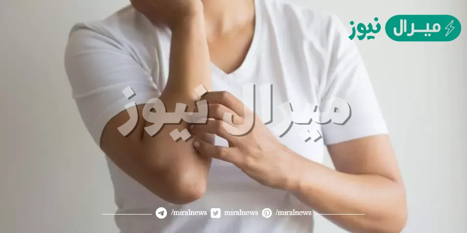 18 علامة تحذيرية في جسمك تدل على أن كبدك في خطر منها الشعور بحكة في الجلد