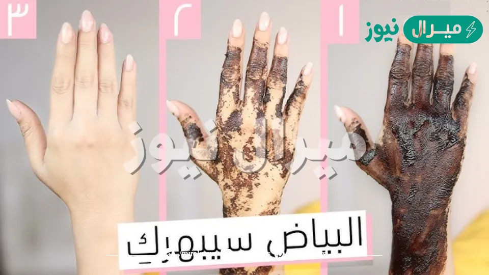 اتحداكي أن لم يبيض يديكي ضعيه ربع ساعة لتبييض اليدين وازالة البقع الغامقة والاسمرار بسرعة