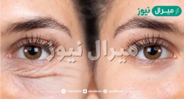أقوي الخلطات الطبيعية لإزالة التجاعيد تحت العين وتخفيف الانتفاخات