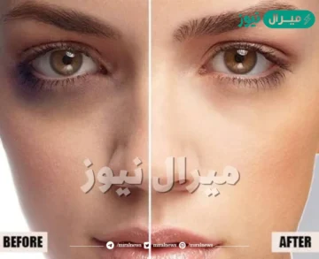 أسرع كريم لتبييض البشرة وإزالة الهالات السوداء والتجاعيد في دقائق