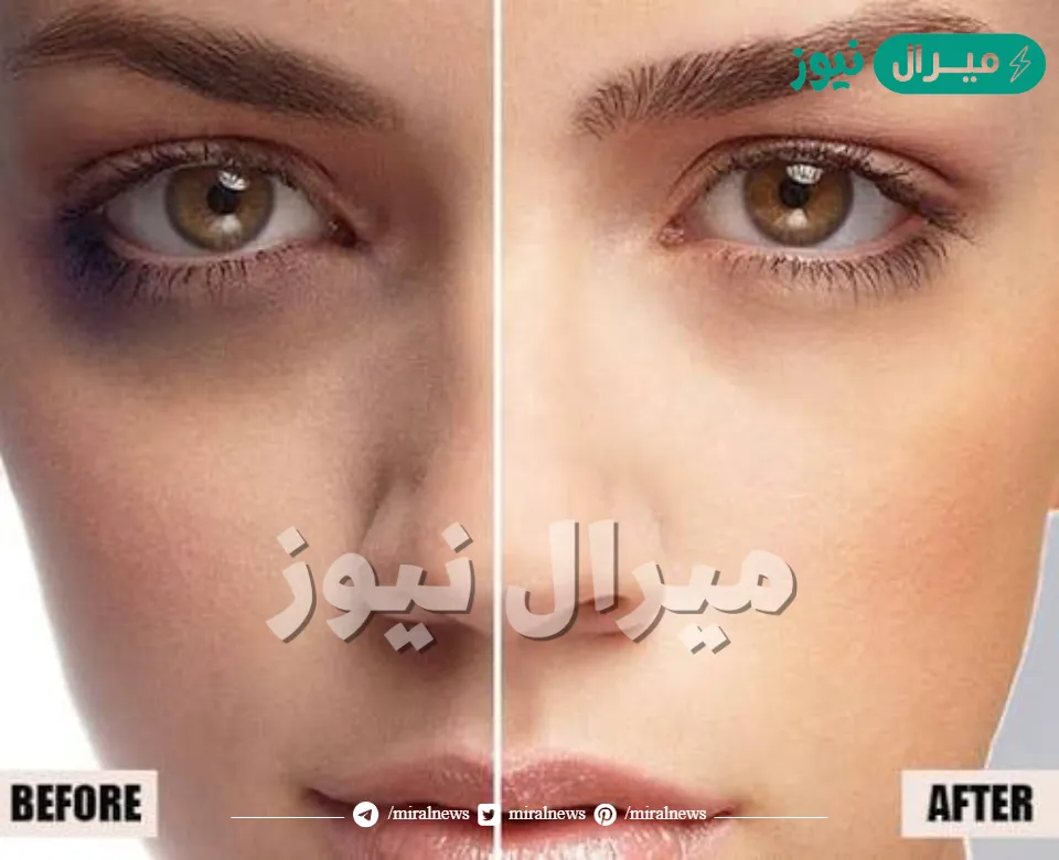 أسرع كريم لتبييض البشرة وإزالة الهالات السوداء والتجاعيد في دقائق