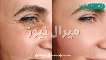 أسرع كريم لتفتيح البشرة وشدها والتخلص من التجاعيد بشكل دائم في دقائق