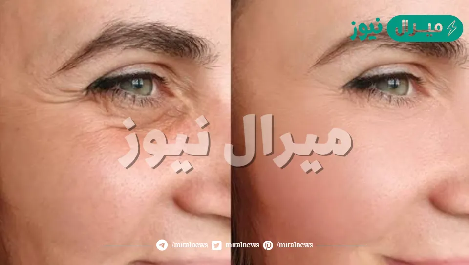 أسرع كريم لتفتيح البشرة وشدها والتخلص من التجاعيد بشكل دائم في دقائق