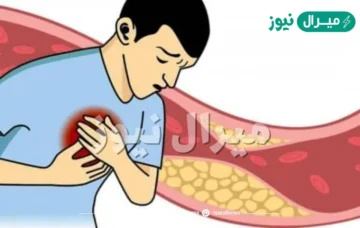 اسوأ طعام يتسبب في ارتفاع الكوليسترول بشكل خطير للغاية سم قاتل يفقدك حياتك بلمح البصر ابتعد عنه فوراً
