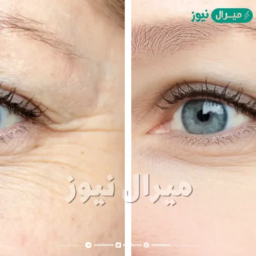 أفضل قناع لمنع التجاعيد وشد الوجه وحمايته من الشيخوخة لبشرة أكثر نضارة