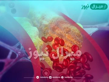 أقوي خلطة لتنظيف الشرايين من الدهون المتراكمة وتوسيع الأوعية الدموية في أسبوع